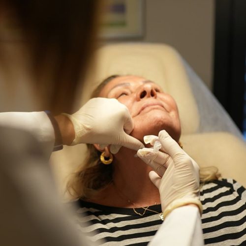 Zabiegi kaniulą dermatologiczną
