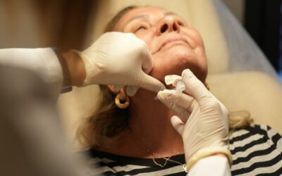 Zabiegi kaniulą dermatologiczną a opór tkanek i płynów. Co trzeba wiedzieć?