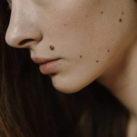 Dermatoskopia